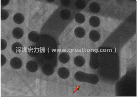 BGA因為焊墊變小，造成錫膏過多而最終形成焊接短路的結果。